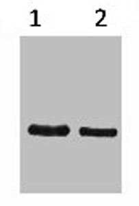 Western blot analysis of SRT-Recombinant protein, diluted at 1) 1:5000 2) 1:10000