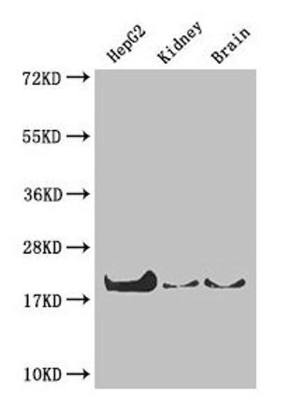 Western Blot<br />
 Positive WB detected in: HepG2 whole cell lysate, Mouse kidney tissue, Mouse brain tissue<br />
 All lanes: PPIA antibody at 4µg/ml<br />
 Secondary<br />
 Goat polyclonal to rabbit IgG at 1/50000 dilution<br />
 Predicted band size: 19, 12 kDa<br />
 Observed band size: 19 kDa<br />