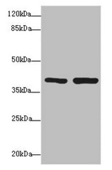 Western blot<br />
 All lanes: PDCD2L antibody at 1.69µg/ml<br />
 Lane 1: Hela whole cell lysate<br />
 Lane 2: MCF-7 whole cell lysate<br />
 Secondary<br />
 Goat polyclonal to rabbit IgG at 1/10000 dilution<br />
 Predicted band size: 39 kDa<br />
 Observed band size: 39 kDa<br />