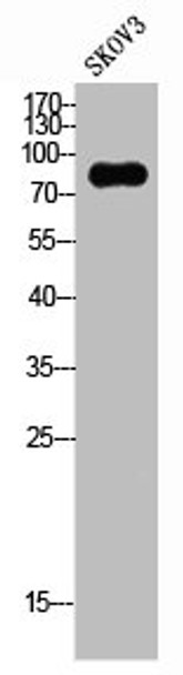 Western Blot analysis of SKOV3 cells using G-CSFR Polyclonal Antibody Western Blot analysis of SKOV3 cells using G-CSFR Polyclonal Antibody