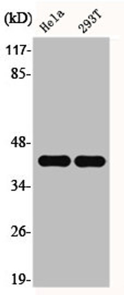Western Blot analysis of HELA 293T cells using Ephrin-B1/2 Polyclonal Antibody Western Blot analysis of HELA 293T cells using Ephrin-B1/2 Polyclonal Antibody
