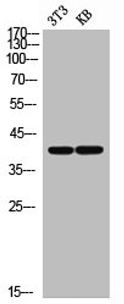Western Blot analysis of NIH-3T3 KB cells using CD33 Polyclonal Antibody Western Blot analysis of NIH-3T3 KB cells using CD33 Polyclonal Antibody