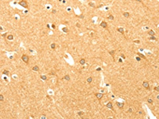 The image on the left is immunohistochemistry of paraffin-embedded Human brain tissue using CSB-PA953606 (AARS2 Antibody) at dilution 1/40, on the right is treated with fusion protein. (Original magnification: ×200) The image on the left is immunohistochemistry of paraffin-embedded Human brain tissue using CSB-PA953606 (AARS2 Antibody) at dilution 1/40, on the right is treated with fusion protein. (Original magnification: ×200)
