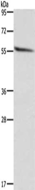 Gel: 8%SDS-PAGE, Lysate: 40 μg, Lane: Human fetal brain tissue, Primary antibody: CSB-PA206692 (ACVR2B Antibody) at dilution 1/300, Secondary antibody: Goat anti rabbit IgG at 1/8000 dilution, Exposure time: 20 seconds Gel: 8%SDS-PAGE, Lysate: 40 μg, Lane: Human fetal brain tissue, Primary antibody: CSB-PA206692 (ACVR2B Antibody) at dilution 1/300, Secondary antibody: Goat anti rabbit IgG at 1/8000 dilution, Exposure time: 20 seconds