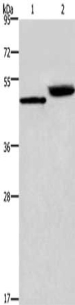 Gel: 8%SDS-PAGE, Lysate: 40 μg, Lane 1-2: Human stomach cancer tissue, mouse stomach tissue, Primary antibody: CSB-PA296813 (CTSE Antibody) at dilution 1/450, Secondary antibody: Goat anti rabbit IgG at 1/8000 dilution, Exposure time: 20 seconds Gel: 8%SDS-PAGE, Lysate: 40 μg, Lane 1-2: Human stomach cancer tissue, mouse stomach tissue, Primary antibody: CSB-PA296813 (CTSE Antibody) at dilution 1/450, Secondary antibody: Goat anti rabbit IgG at 1/8000 dilution, Exposure time: 20 seconds
