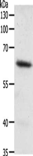 Gel: 10%SDS-PAGE, Lysate: 50 μg, Lane: Mouse heart tissue, Primary antibody: CSB-PA913541 (FZD4 Antibody) at dilution 1/200, Secondary antibody: Goat anti rabbit IgG at 1/8000 dilution, Exposure time: 10 seconds Gel: 10%SDS-PAGE, Lysate: 50 μg, Lane: Mouse heart tissue, Primary antibody: CSB-PA913541 (FZD4 Antibody) at dilution 1/200, Secondary antibody: Goat anti rabbit IgG at 1/8000 dilution, Exposure time: 10 seconds