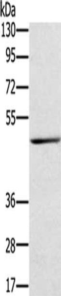 Gel: 8%SDS-PAGE, Lysate: 40 μg, Lane: Human stomach cancer tissue, Primary antibody: CSB-PA290336 (TRIM31 Antibody) at dilution 1/250, Secondary antibody: Goat anti rabbit IgG at 1/8000 dilution, Exposure time: 5 minutes Gel: 8%SDS-PAGE, Lysate: 40 μg, Lane: Human stomach cancer tissue, Primary antibody: CSB-PA290336 (TRIM31 Antibody) at dilution 1/250, Secondary antibody: Goat anti rabbit IgG at 1/8000 dilution, Exposure time: 5 minutes
