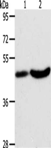 Gel: 10%SDS-PAGE, Lysate: 40 μg, Lane 1-2: Human liver cancer tissue, mouse brain tissue, Primary antibody: CSB-PA065885 (PLIN2 Antibody) at dilution 1/200, Secondary antibody: Goat anti rabbit IgG at 1/8000 dilution, Exposure time: 40 seconds Gel: 10%SDS-PAGE, Lysate: 40 μg, Lane 1-2: Human liver cancer tissue, mouse brain tissue, Primary antibody: CSB-PA065885 (PLIN2 Antibody) at dilution 1/200, Secondary antibody: Goat anti rabbit IgG at 1/8000 dilution, Exposure time: 40 seconds
