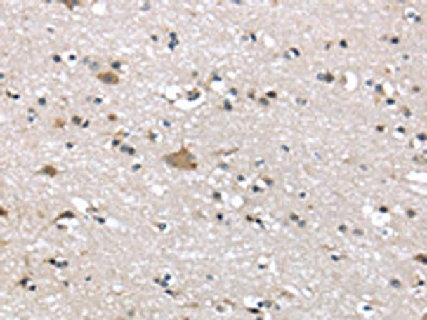 The image on the left is immunohistochemistry of paraffin-embedded Human brain tissue using CSB-PA235900 (ADRB3 Antibody) at dilution 1/20, on the right is treated with synthetic peptide. (Original magnification: ×200) The image on the left is immunohistochemistry of paraffin-embedded Human brain tissue using CSB-PA235900 (ADRB3 Antibody) at dilution 1/20, on the right is treated with synthetic peptide. (Original magnification: ×200)