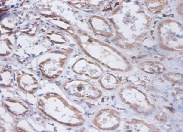 Immunohistochemistry of paraffin-embedded human kidney tissue using CSB-PA02925A0Rb at dilution of 1:100 Immunohistochemistry of paraffin-embedded human kidney tissue using CSB-PA02925A0Rb at dilution of 1:100
