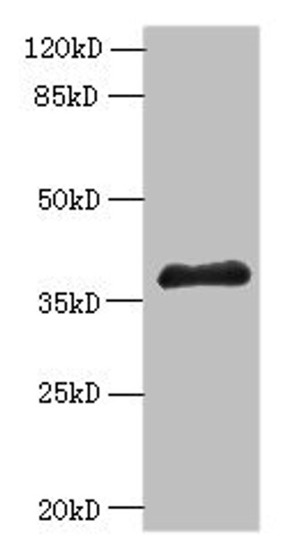 Western blot<br />
 All lanes: ELAVL1 antibody at 6µg/ml + A431 whole cell lysate<br />
 Secondary<br />
 Goat polyclonal to rabbit IgG at 1/10000 dilution<br />
 Predicted band size: 37, 39 kDa<br />
 Observed band size: 37 kDa<br /> Western blot<br />
 All lanes: ELAVL1 antibody at 6µg/ml + A431 whole cell lysate<br />
 Secondary<br />
 Goat polyclonal to rabbit IgG at 1/10000 dilution<br />
 Predicted band size: 37, 39 kDa<br />
 Observed band size: 37 kDa<br />