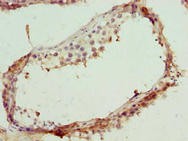 Immunohistochemistry of paraffin-embedded human testis tissue using CSB-PA732917LA01HU at dilution of 1:100 Immunohistochemistry of paraffin-embedded human testis tissue using CSB-PA732917LA01HU at dilution of 1:100