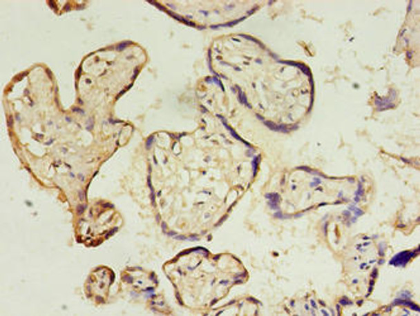 Immunohistochemistry of paraffin-embedded human placenta tissue using CSB-PA765975EA01HU at dilution of 1:100 Immunohistochemistry of paraffin-embedded human placenta tissue using CSB-PA765975EA01HU at dilution of 1:100