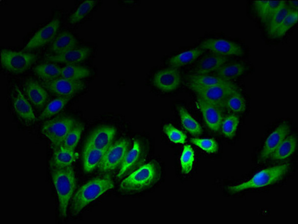 Immunofluorescent analysis of HepG2 cells using CSB-PA822677LA01HU at dilution of 1:100 and Alexa Fluor 488-congugated AffiniPure Goat Anti-Rabbit IgG (H+L) Immunofluorescent analysis of HepG2 cells using CSB-PA822677LA01HU at dilution of 1:100 and Alexa Fluor 488-congugated AffiniPure Goat Anti-Rabbit IgG (H+L)