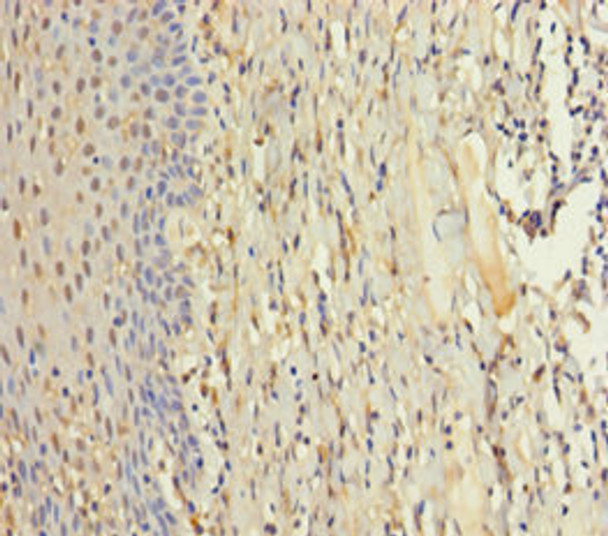 Immunohistochemistry of paraffin-embedded human tonsil tissue using CSB-PA866211LA01HU at dilution of 1:100 Immunohistochemistry of paraffin-embedded human tonsil tissue using CSB-PA866211LA01HU at dilution of 1:100