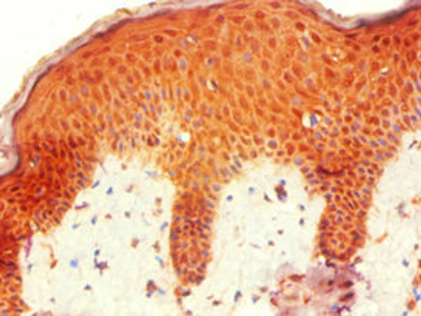 Immunohistochemistry of paraffin-embedded human skin tissue using CSB-PA010667ESR1HU at dilution of 1:100 Immunohistochemistry of paraffin-embedded human skin tissue using CSB-PA010667ESR1HU at dilution of 1:100