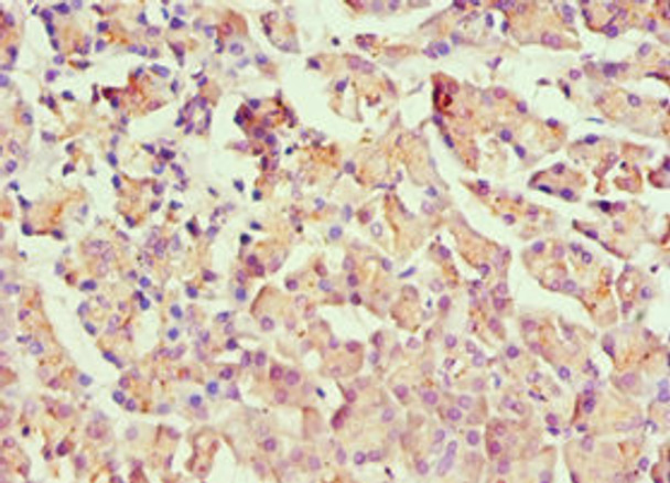 Immunohistochemistry of paraffin-embedded human pancreatic tissue using CSB-PA010667ESR1HU at dilution of 1:100 Immunohistochemistry of paraffin-embedded human pancreatic tissue using CSB-PA010667ESR1HU at dilution of 1:100