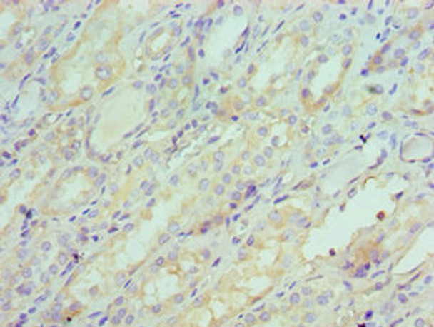 Immunohistochemistry of paraffin-embedded human kidney tissue using CSB-PA021062ESR2HU at dilution of 1:100 Immunohistochemistry of paraffin-embedded human kidney tissue using CSB-PA021062ESR2HU at dilution of 1:100