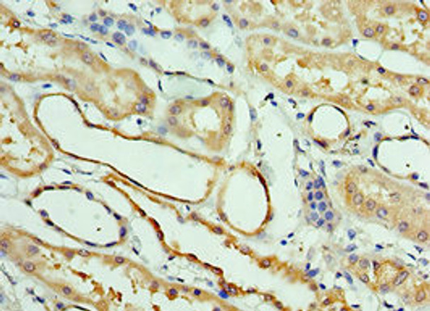 Immunohistochemistry of paraffin-embedded human kidney tissue using CSB-PA896480ESR2HU at dilution of 1:100 Immunohistochemistry of paraffin-embedded human kidney tissue using CSB-PA896480ESR2HU at dilution of 1:100