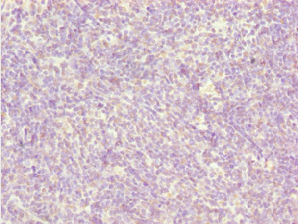 Immunohistochemistry of paraffin-embedded human thymus tissue using CSB-PA872507ESR1HU at dilution of 1:100 Immunohistochemistry of paraffin-embedded human thymus tissue using CSB-PA872507ESR1HU at dilution of 1:100