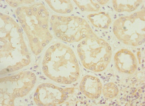 Immunohistochemistry of paraffin-embedded human kidney tissue using CSB-PA881016ESR2HU at dilution of 1:100 Immunohistochemistry of paraffin-embedded human kidney tissue using CSB-PA881016ESR2HU at dilution of 1:100