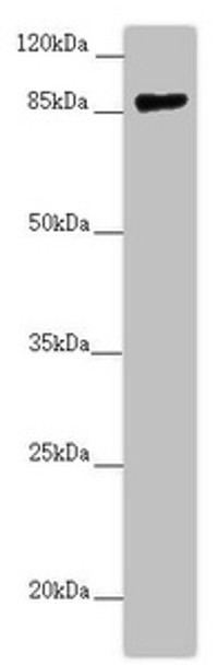 Western blot<br />
 All lanes: CCHCR1 antibody at 2.67 µg/ml + 293T whole cell lysate<br />
 Secondary<br />
 Goat polyclonal to rabbit IgG at 1/10000 dilution<br />
 Predicted band size: 89, 100, 96 kDa<br />
 Observed band size: 89 kDa<br /> Western blot<br />
 All lanes: CCHCR1 antibody at 2.67 µg/ml + 293T whole cell lysate<br />
 Secondary<br />
 Goat polyclonal to rabbit IgG at 1/10000 dilution<br />
 Predicted band size: 89, 100, 96 kDa<br />
 Observed band size: 89 kDa<br />