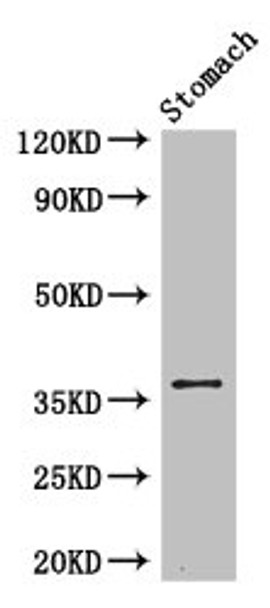 Western Blot<br />
 Positive WB detected in: Mouse stomach tissue<br />
 All lanes: PIM3 antibody at 3.4µg/ml<br />
 Secondary<br />
 Goat polyclonal to rabbit IgG at 1/50000 dilution<br />
 Predicted band size: 36 kDa<br />
 Observed band size: 36 kDa<br /> Western Blot<br />
 Positive WB detected in: Mouse stomach tissue<br />
 All lanes: PIM3 antibody at 3.4µg/ml<br />
 Secondary<br />
 Goat polyclonal to rabbit IgG at 1/50000 dilution<br />
 Predicted band size: 36 kDa<br />
 Observed band size: 36 kDa<br />