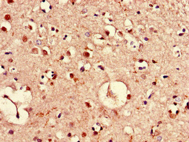 Immunohistochemistry of paraffin-embedded human brain tissue using CSB-PA771444LA01HU at dilution of 1:100 Immunohistochemistry of paraffin-embedded human brain tissue using CSB-PA771444LA01HU at dilution of 1:100