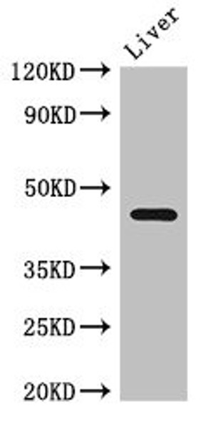 Western Blot<br />
 Positive WB detected in: Mouse liver tissue<br />
 All lanes: NGFR antibody at 2.7µg/ml<br />
 Secondary<br />
 Goat polyclonal to rabbit IgG at 1/50000 dilution<br />
 Predicted band size: 46, 36 kDa<br />
 Observed band size: 46 kDa<br /> Western Blot<br />
 Positive WB detected in: Mouse liver tissue<br />
 All lanes: NGFR antibody at 2.7µg/ml<br />
 Secondary<br />
 Goat polyclonal to rabbit IgG at 1/50000 dilution<br />
 Predicted band size: 46, 36 kDa<br />
 Observed band size: 46 kDa<br />