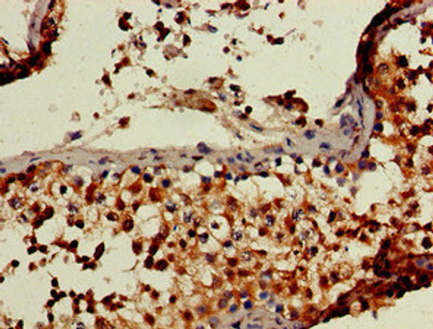 Immunohistochemistry of paraffin-embedded human testis tissue using CSB-PA768776LA01HU at dilution of 1:100 Immunohistochemistry of paraffin-embedded human testis tissue using CSB-PA768776LA01HU at dilution of 1:100