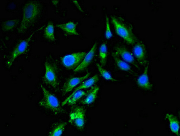 Immunofluorescent analysis of Hela cells using CSB-PA768776LA01HU at dilution of 1:100 and Alexa Fluor 488-congugated AffiniPure Goat Anti-Rabbit IgG (H+L) Immunofluorescent analysis of Hela cells using CSB-PA768776LA01HU at dilution of 1:100 and Alexa Fluor 488-congugated AffiniPure Goat Anti-Rabbit IgG (H+L)