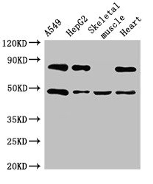 Western Blot<br />
 Positive WB detected in: A549 whole cell lysate, HepG2 whole cell lysate, Mouse skeletal muscle tissue, Rat heart tissue<br />
 All lanes: ASB4 antibody at 3µg/ml<br />
 Secondary<br />
 Goat polyclonal to rabbit IgG at 1/50000 dilution<br />
 Predicted band size: 49, 39 kDa<br />
 Observed band size: 49 kDa<br /> Western Blot<br />
 Positive WB detected in: A549 whole cell lysate, HepG2 whole cell lysate, Mouse skeletal muscle tissue, Rat heart tissue<br />
 All lanes: ASB4 antibody at 3µg/ml<br />
 Secondary<br />
 Goat polyclonal to rabbit IgG at 1/50000 dilution<br />
 Predicted band size: 49, 39 kDa<br />
 Observed band size: 49 kDa<br />