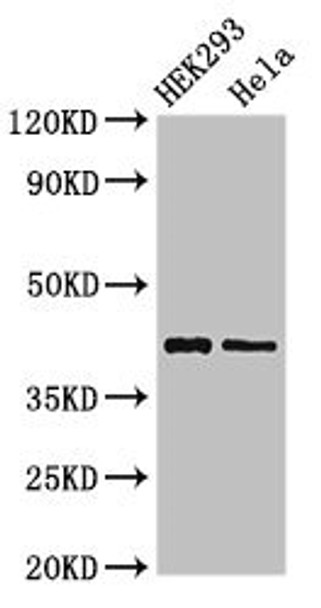 Western Blot<br />
 Positive WB detected in: HEK293 whole cell lysate, Hela whole cell lysate<br />
 All lanes: GALK1 antibody at 3µg/ml<br />
 Secondary<br />
 Goat polyclonal to rabbit IgG at 1/50000 dilution<br />
 Predicted band size: 43, 46 kDa<br />
 Observed band size: 43 kDa<br /> Western Blot<br />
 Positive WB detected in: HEK293 whole cell lysate, Hela whole cell lysate<br />
 All lanes: GALK1 antibody at 3µg/ml<br />
 Secondary<br />
 Goat polyclonal to rabbit IgG at 1/50000 dilution<br />
 Predicted band size: 43, 46 kDa<br />
 Observed band size: 43 kDa<br />