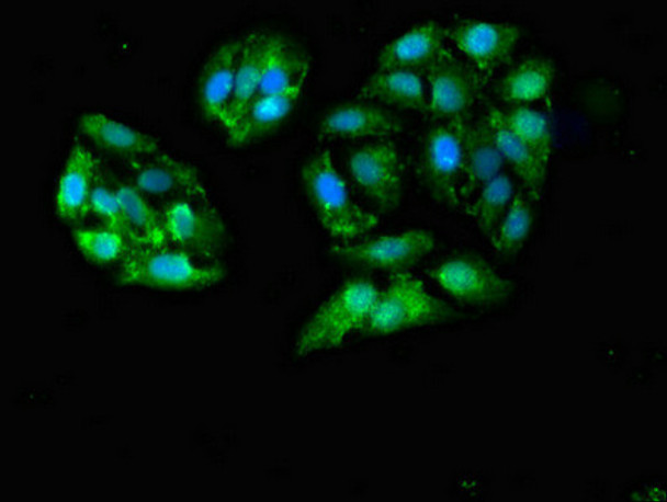Immunofluorescent analysis of HepG2 cells using CSB-PA009198LA01HU at dilution of 1:100 and Alexa Fluor 488-congugated AffiniPure Goat Anti-Rabbit IgG (H+L) Immunofluorescent analysis of HepG2 cells using CSB-PA009198LA01HU at dilution of 1:100 and Alexa Fluor 488-congugated AffiniPure Goat Anti-Rabbit IgG (H+L)