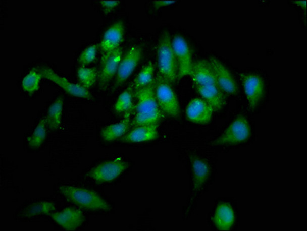 Immunofluorescence staining of Hela cells with CSB-PA026107LA01HU at 1:133, counter-stained with DAPI. The cells were fixed in 4% formaldehyde, permeabilized using 0.2% Triton X-100 and blocked in 10% normal Goat Serum. The cells were then incubated with the antibody overnight at 4°C. The secondary antibody was Alexa Fluor 488-congugated AffiniPure Goat Anti-Rabbit IgG (H+L) . Immunofluorescence staining of Hela cells with CSB-PA026107LA01HU at 1:133, counter-stained with DAPI. The cells were fixed in 4% formaldehyde, permeabilized using 0.2% Triton X-100 and blocked in 10% normal Goat Serum. The cells were then incubated with the antibody overnight at 4°C. The secondary antibody was Alexa Fluor 488-congugated AffiniPure Goat Anti-Rabbit IgG (H+L) .