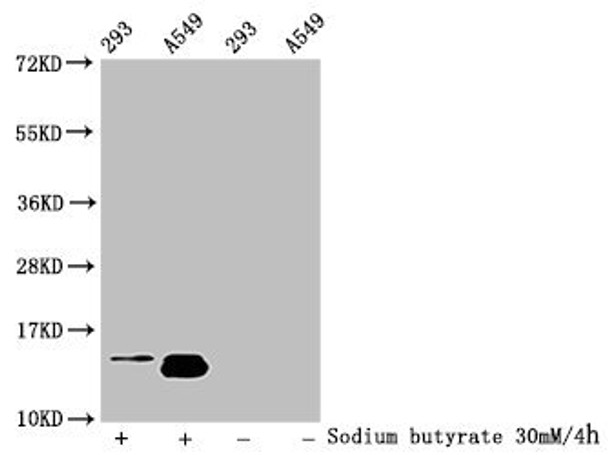 Western Blot<br />
 Detected samples: 293 whole cell lysate, A549 whole cell lysate; Untreated (-) or treated (+) with 30mM sodium butyrate for 4h<br />
 All lanes: HIST1H2BC antibody at 1:100<br />
 Secondary<br />
 Goat polyclonal to rabbit IgG at 1/50000 dilution<br />
 Predicted band size: 14 kDa<br />
 Observed band size: 14 kDa<br /> Western Blot<br />
 Detected samples: 293 whole cell lysate, A549 whole cell lysate; Untreated (-) or treated (+) with 30mM sodium butyrate for 4h<br />
 All lanes: HIST1H2BC antibody at 1:100<br />
 Secondary<br />
 Goat polyclonal to rabbit IgG at 1/50000 dilution<br />
 Predicted band size: 14 kDa<br />
 Observed band size: 14 kDa<br />