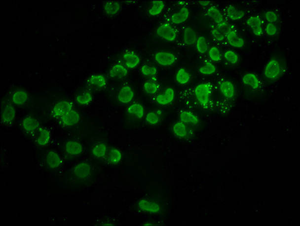 Immunofluorescence staining of Hela cells (treated with 30mM sodium butyrate for 4h) with CSB-PA010403OA116acHU at 1:2.5, counter-stained with DAPI. The cells were fixed in 4% formaldehyde, permeabilized using 0.2% Triton X-100 and blocked in 10% normal Goat Serum. The cells were then incubated with the antibody overnight at 4°C. The secondary antibody was Alexa Fluor 488-congugated AffiniPure Goat Anti-Rabbit IgG (H+L) . Immunofluorescence staining of Hela cells (treated with 30mM sodium butyrate for 4h) with CSB-PA010403OA116acHU at 1:2.5, counter-stained with DAPI. The cells were fixed in 4% formaldehyde, permeabilized using 0.2% Triton X-100 and blocked in 10% normal Goat Serum. The cells were then incubated with the antibody overnight at 4°C. The secondary antibody was Alexa Fluor 488-congugated AffiniPure Goat Anti-Rabbit IgG (H+L) .