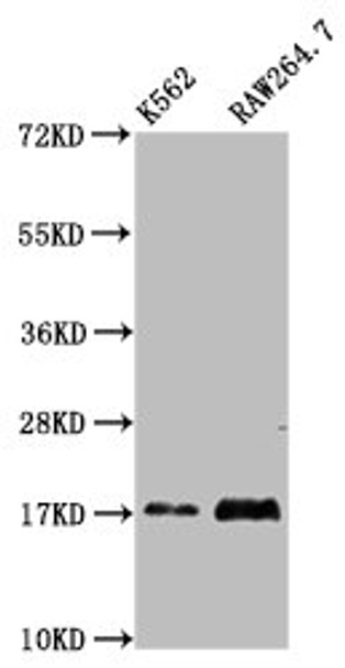 Western Blot<br />
 Positive WB detected in: K562 whole cell lysate, RAW264.7 whole cell lysate<br />
 All lanes: VAMP4 antibody at 4.3µg/ml<br />
 Secondary<br />
 Goat polyclonal to rabbit IgG at 1/50000 dilution<br />
 Predicted band size: 17 kDa<br />
 Observed band size: 17 kDa<br /> Western Blot<br />
 Positive WB detected in: K562 whole cell lysate, RAW264.7 whole cell lysate<br />
 All lanes: VAMP4 antibody at 4.3µg/ml<br />
 Secondary<br />
 Goat polyclonal to rabbit IgG at 1/50000 dilution<br />
 Predicted band size: 17 kDa<br />
 Observed band size: 17 kDa<br />
