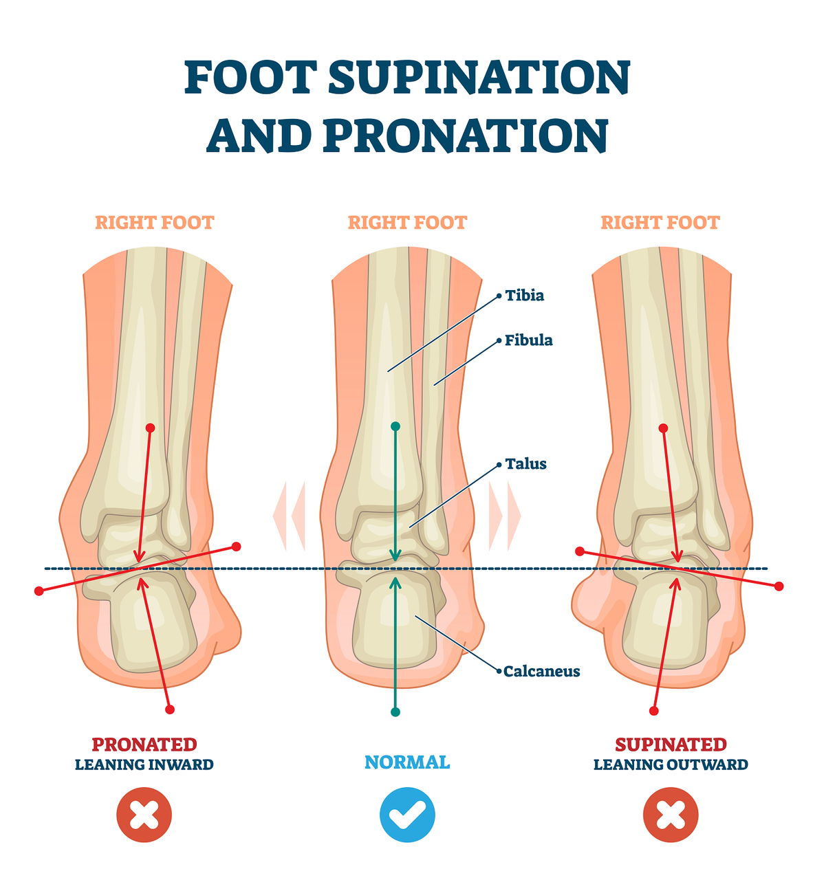 pronation supination feet