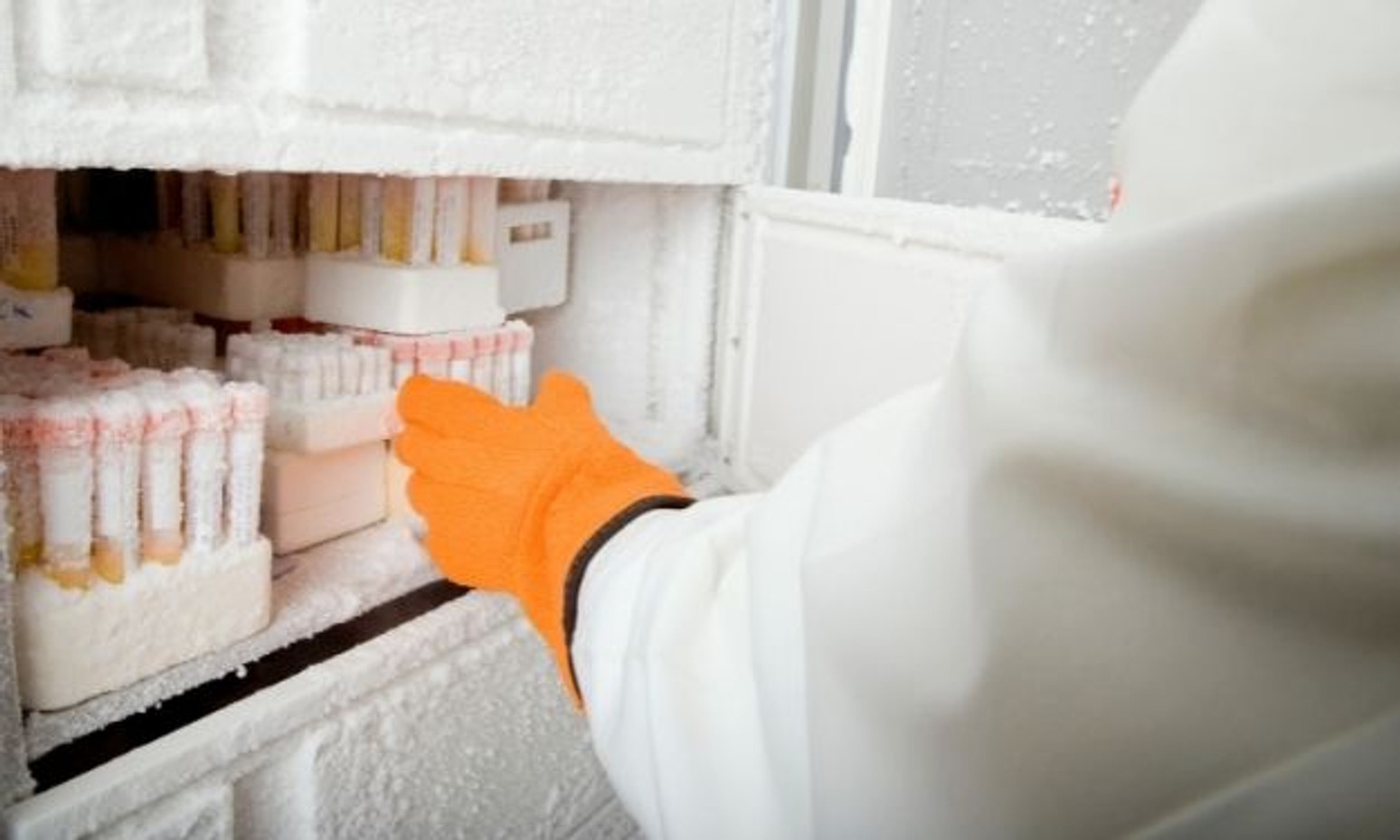 Deep Freezer Benefits Used in Laboratory