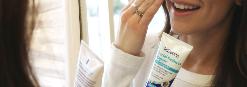 5 Important Tips for Those Who Suffer from Rosacea