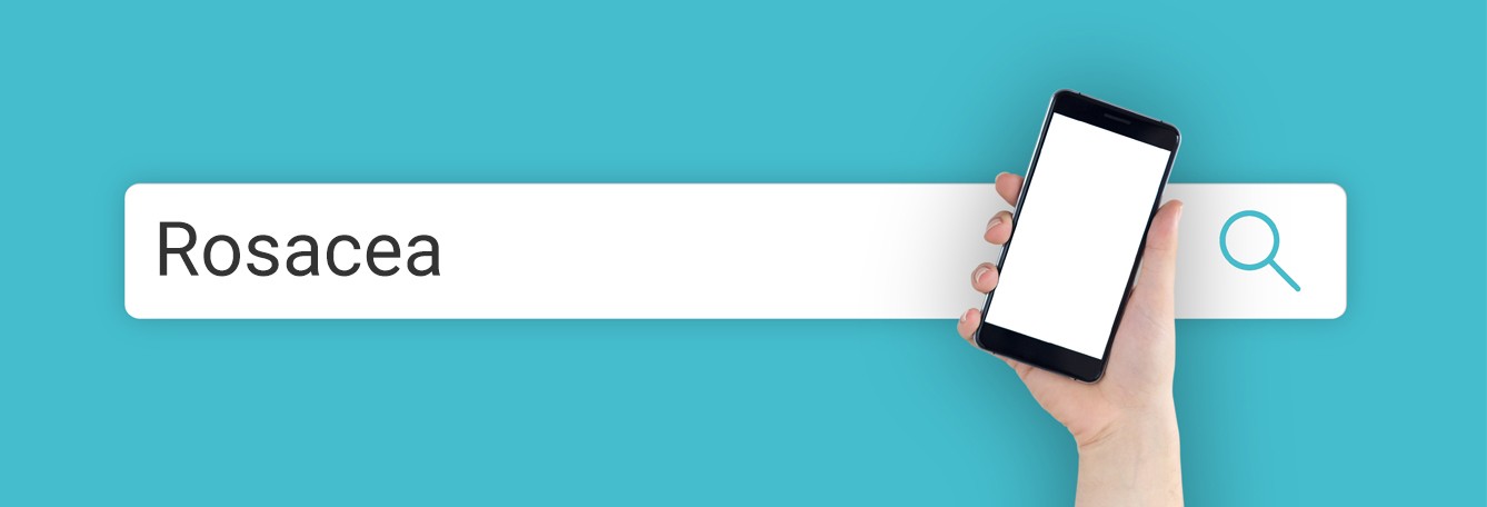 TriDerma Uncovers Five Interesting Facts About Rosacea You Should Know