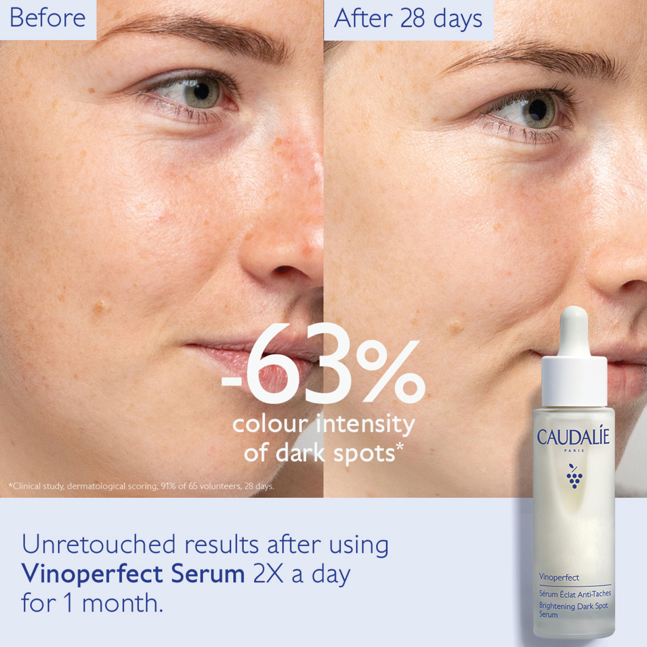 Caudalie Vinoperfect Brightening Dark Spot Serum Supersize 50ml