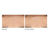 Dr Dennis Gross Professional Grade Resurfacing Liquid Peel Dr Dennis Gross Professional Grade Resurfacing Liquid Peel