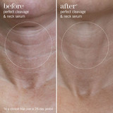 This Works Perfect Cleavage & Neck Serum