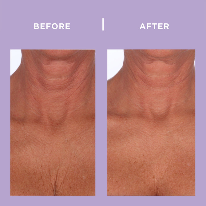 PRAI Ageless Throat & Decolletage Crème Night 50ml