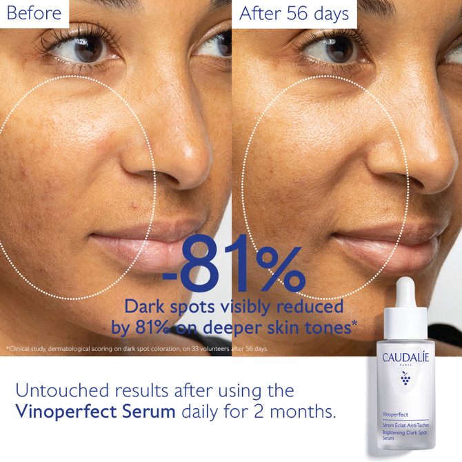 Caudalie Vinoperfect Brightening Dark Spot Serum Duo 2x30ml