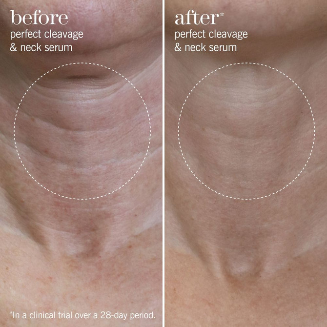 This Works Perfect Cleavage & Neck Serum