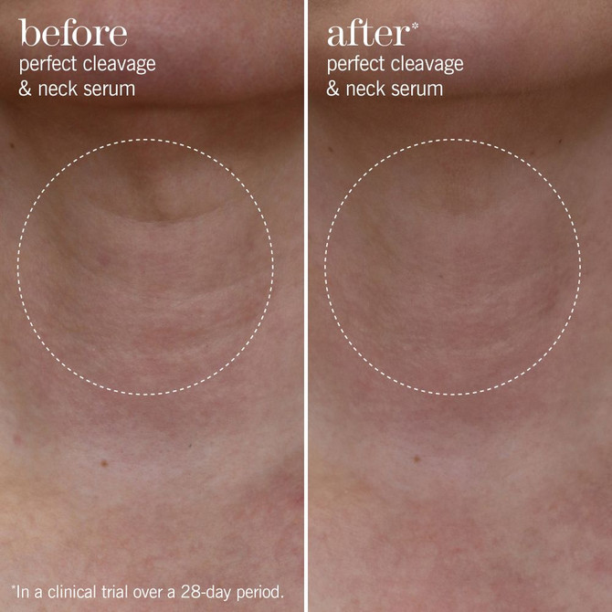 This Works Perfect Cleavage & Neck Serum