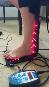 Light Therapy and Lymphedema Light Therapy and Lymphedema